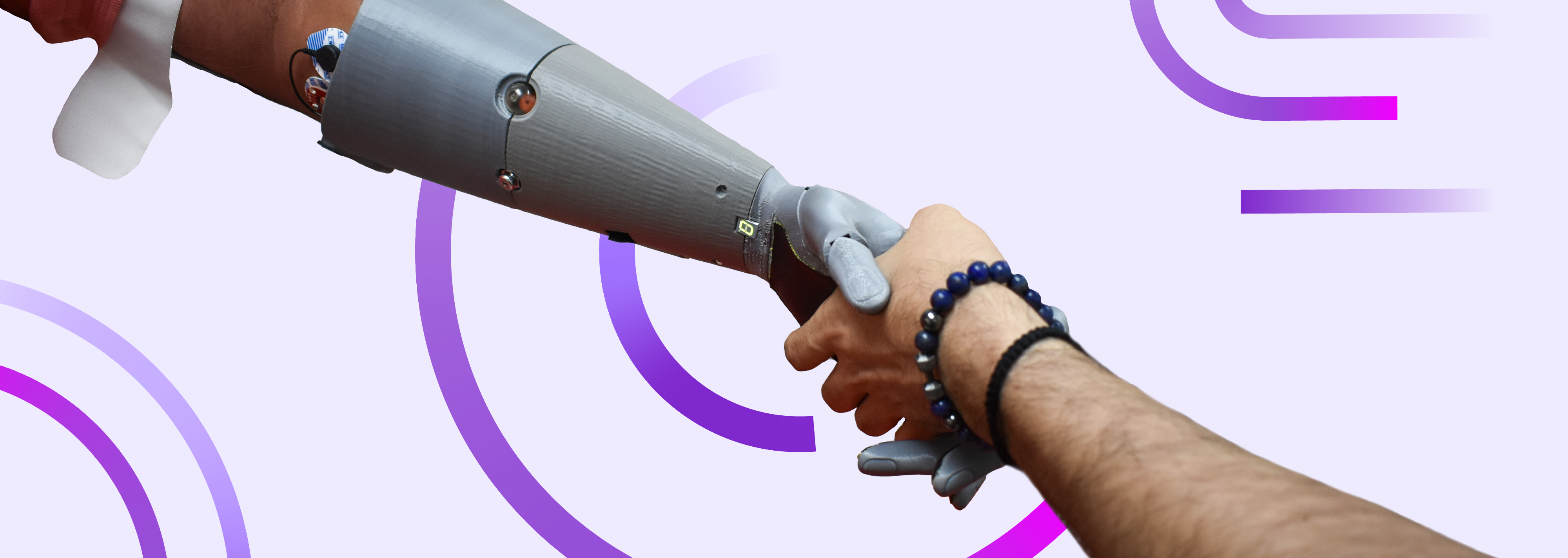 Prótesis de Miembro Superior: Del modelo digital al brazo en funcionamiento